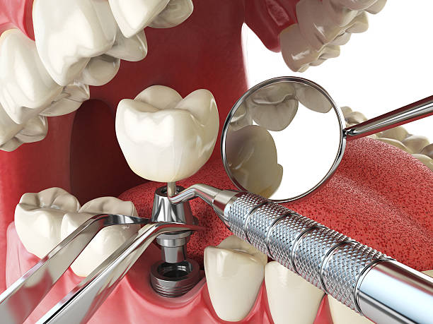 Best Urgent Dental Care for Toothache in Eielson Af, AK